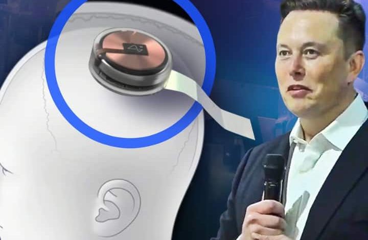 Elon Musk's Neuralink: इंसानी दिमाग में चिप लगाने का पहला ट्रायल इस साल के अंत तक हो सकता है पू